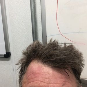 Meet your Posher, Robert